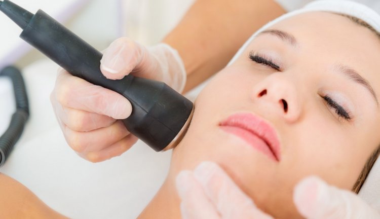 radiofrequenza cellulite