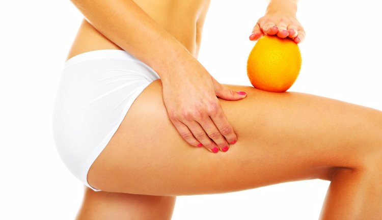 Cellulite ,andiamole contro